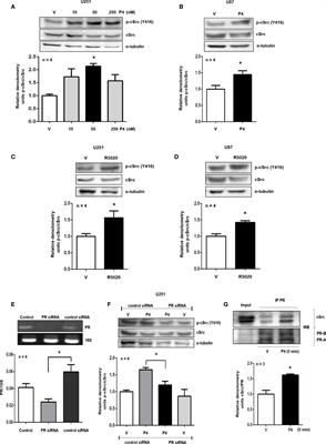 Intracellular Progesterone Receptor and cSrc Protein Working Together to Regulate the Activity of Proteins Involved in Migration and Invasion of Human Glioblastoma Cells